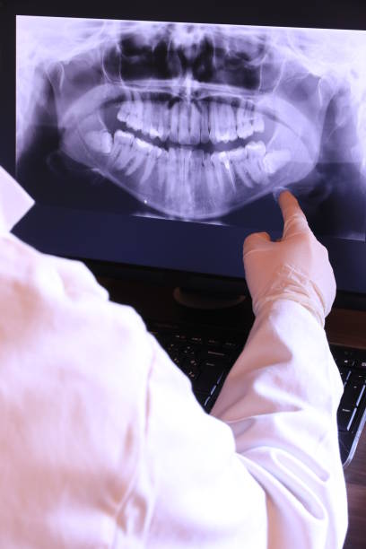 Best Emergency Root Canal Treatment in Oceanport, NJ